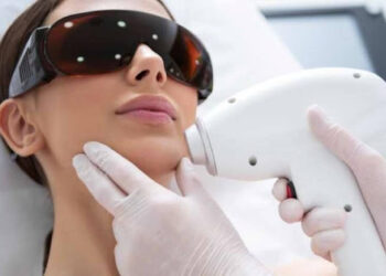 Laser Hair Removal