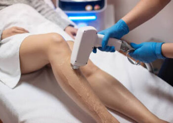 laser hair removal