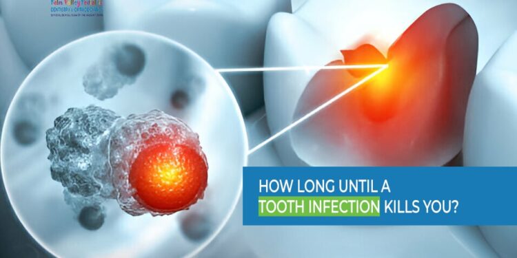 How Long Until a Tooth Infection Kills You