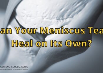 How to Heal a Torn Meniscus Naturally