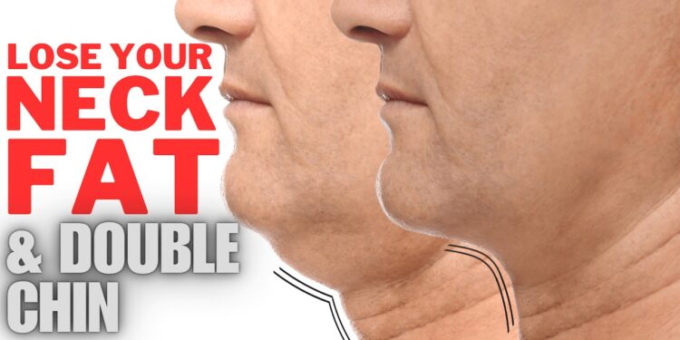 How to Lose Neck Fat