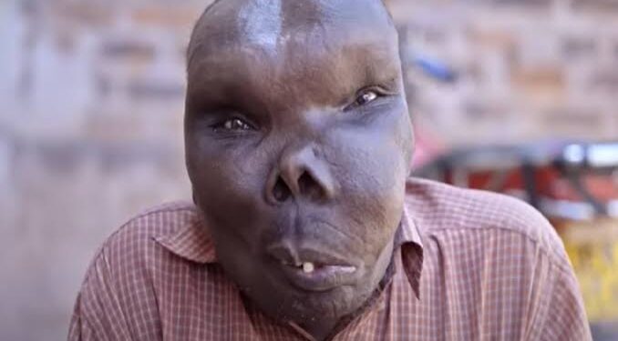 Ugliest People World