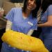 What Does 20 Pounds of Fat Look Like
